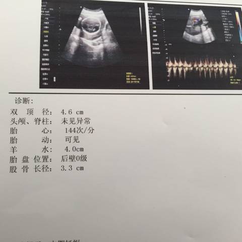 journal_insert_pic_670650033