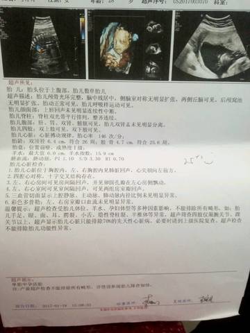 journal_insert_pic_671675118