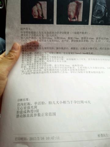 journal_insert_pic_672838413