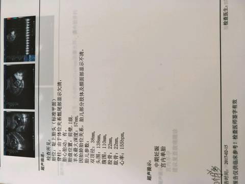 journal_insert_pic_673098719