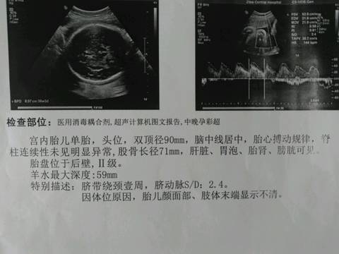 journal_insert_pic_673609045