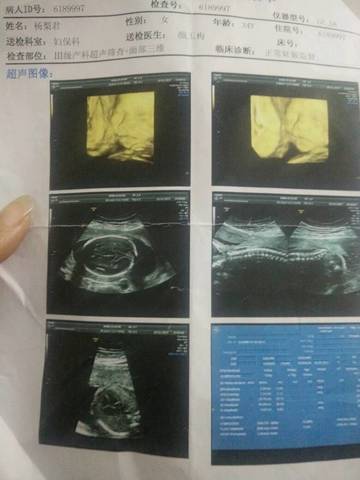 journal_insert_pic_674296279