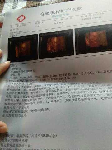 journal_insert_pic_674386604