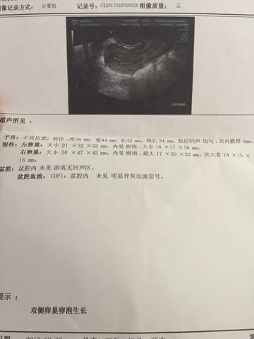 journal_insert_pic_678470337