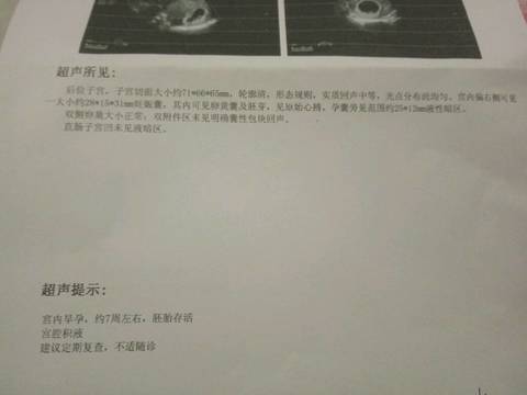 journal_insert_pic_680244012