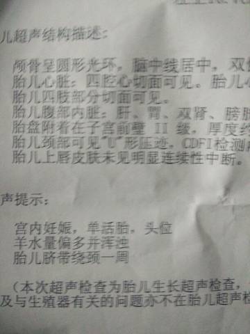 journal_insert_pic_680216178
