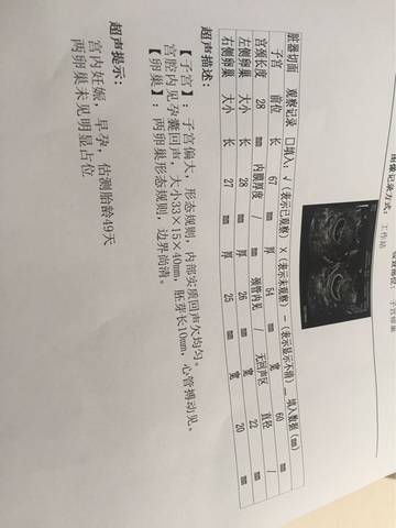 journal_insert_pic_679994554