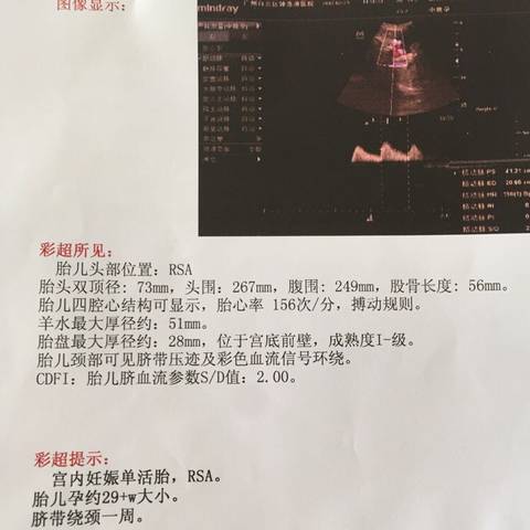 journal_insert_pic_680867002