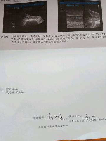 journal_insert_pic_680835887