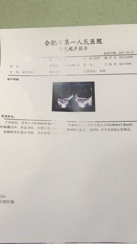 journal_insert_pic_681917530