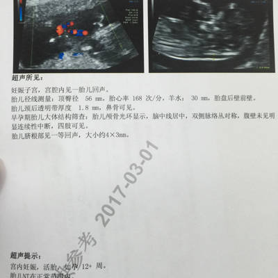 journal_insert_pic_683740438