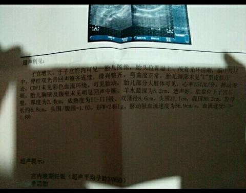 journal_insert_pic_683865551
