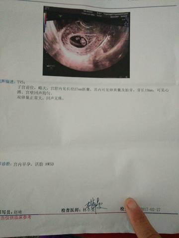 journal_insert_pic_686001644