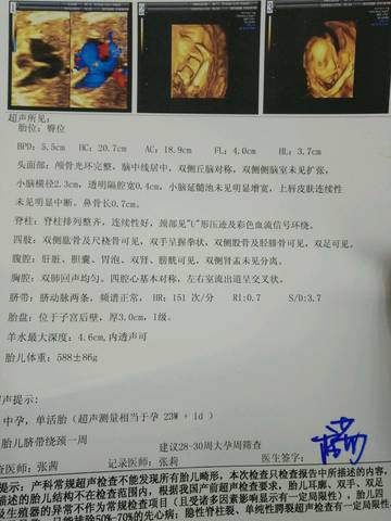 journal_insert_pic_686744596