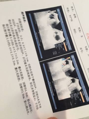 journal_insert_pic_687506313
