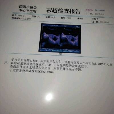 journal_insert_pic_688212345