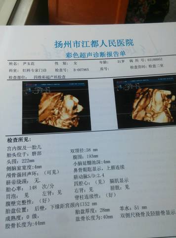 journal_insert_pic_688071844