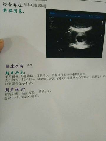 journal_insert_pic_688874551