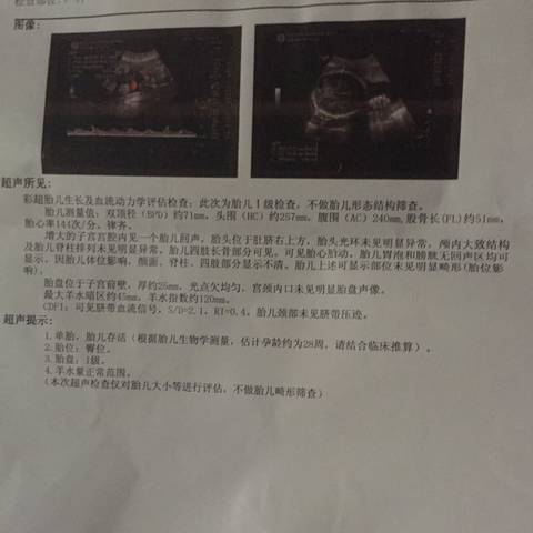 journal_insert_pic_690318457