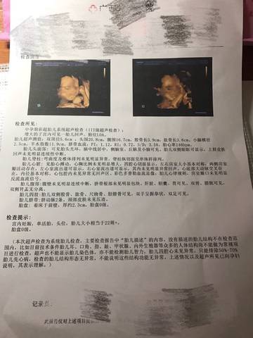 journal_insert_pic_690242262