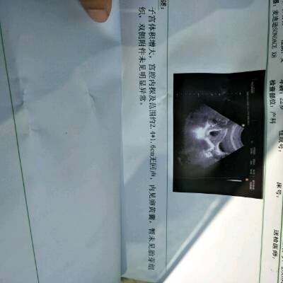 journal_insert_pic_690144909