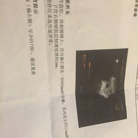 journal_insert_pic_691938386