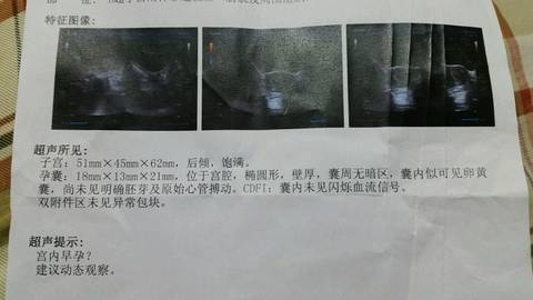 journal_insert_pic_691674825