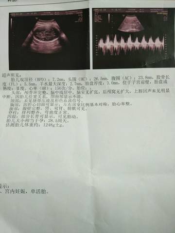 journal_insert_pic_694026069