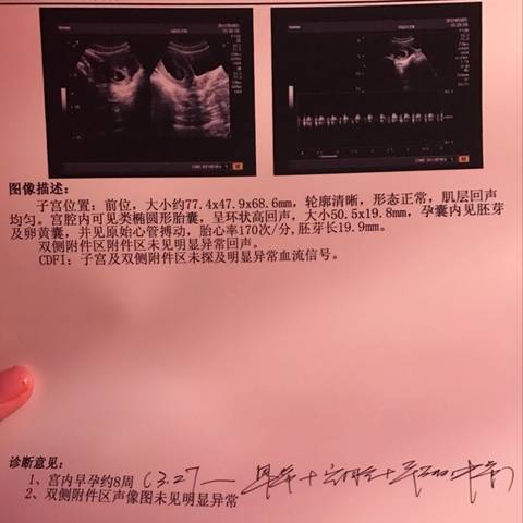 journal_insert_pic_695050302