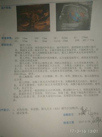 journal_insert_pic_694790301