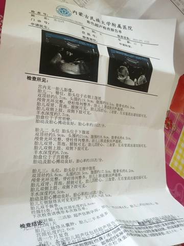 journal_insert_pic_696128590