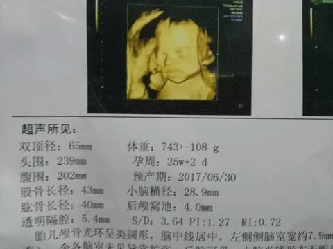 journal_insert_pic_697270664