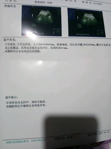 journal_insert_pic_698136376