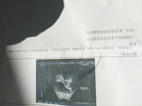 journal_insert_pic_698847098