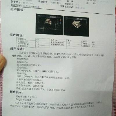 journal_insert_pic_699640246