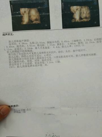 journal_insert_pic_702330045