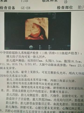 journal_insert_pic_703218554