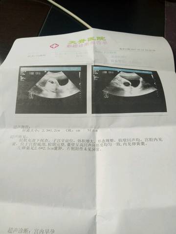 journal_insert_pic_703006975