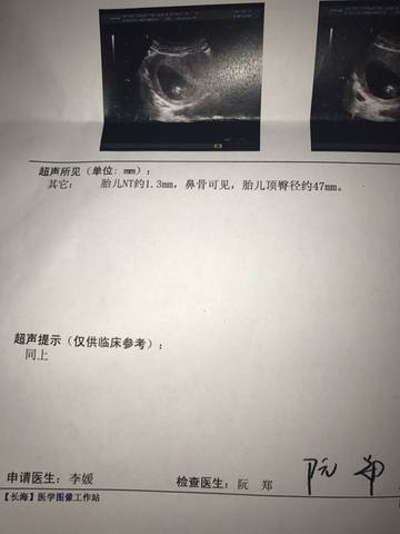 journal_insert_pic_704830052