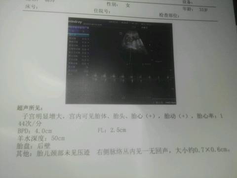 journal_insert_pic_706315797