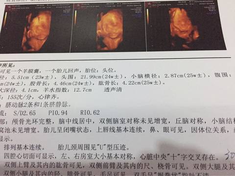 journal_insert_pic_707813899