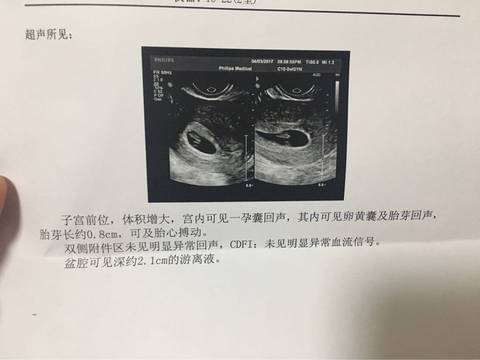 journal_insert_pic_709084194