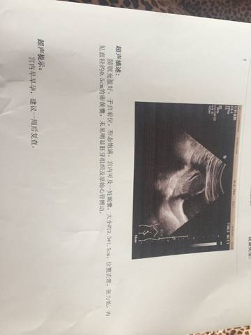journal_insert_pic_710056543