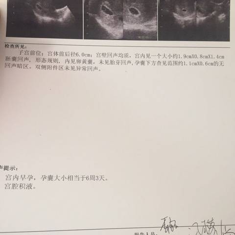 journal_insert_pic_711006197