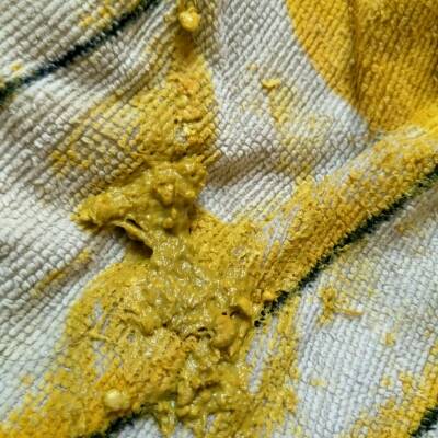 45天的宝宝大便有颗粒是怎麼了