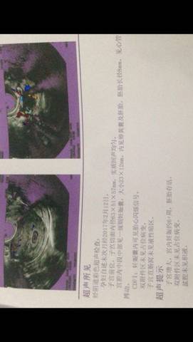 journal_insert_pic_710994448