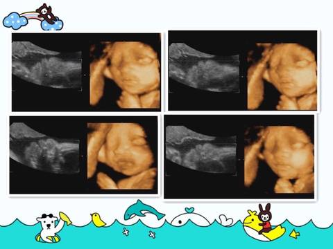 journal_insert_pic_712694842