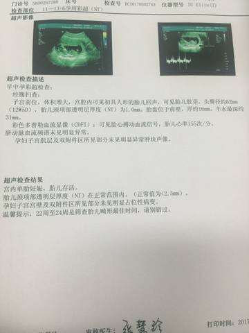 journal_insert_pic_714791284