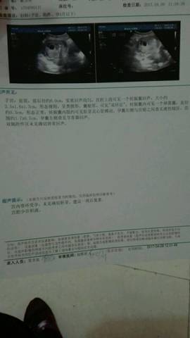 journal_insert_pic_715579105