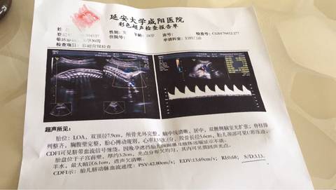 journal_insert_pic_716327102